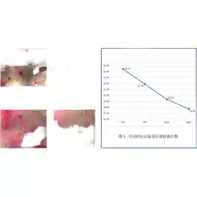 肤漾  清爽型 保湿清爽 油皮痘痘肌油痘肌