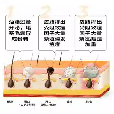 1.5ml*5+1.5ml*5
