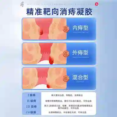 仁和 卡波姆消痔 凝胶