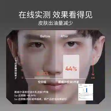 爵威尔 男士温泉控油水保湿控油淡痘印清爽滋润舒缓补水  舒缓肌肤持久保湿爽肤水