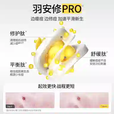 羽素  大灯泡祛痘淡印精华深层清洁护肤套组 击退陈年痘肌 淡化红黑痘印 舒缓泛红 保湿修护控油祛痘