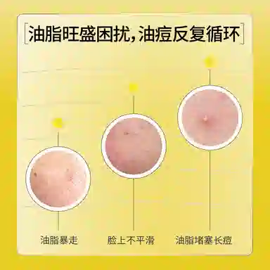 羽素 安肌调理平衡水清痘火 保湿舒缓控油