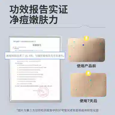 羽素背后痘身体喷雾  痘痘粉刺控油清洁美背