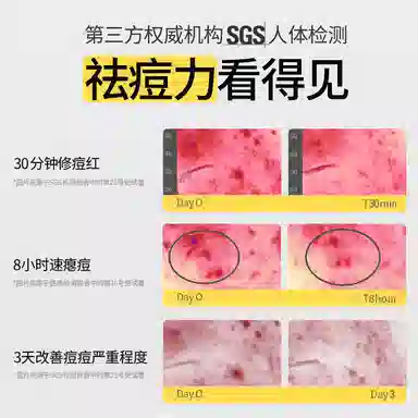 羽素  修护淡痘印滋润祛痘 油皮混合肌