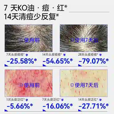 EHD 500ml