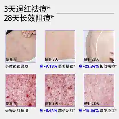 EHD 500ml*1500*2