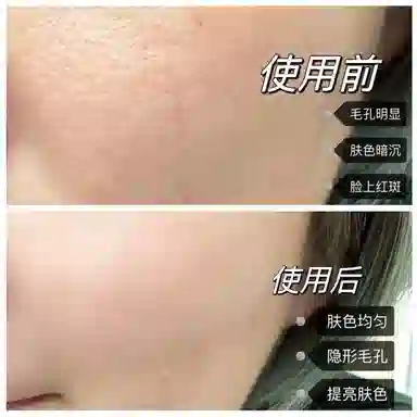 MAGELINE 10g