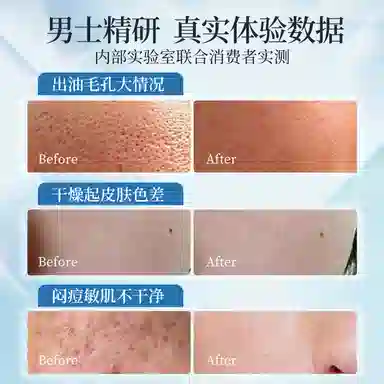 MKAK 120ml*2120ml*2+140ml