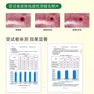 丽普司肽 祛痘修护护肤套装 祛痘淡痘印修护 立体修护冻干粉+专研祛痘精华液+植萃清透精华水