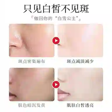 年蔻  美白祛斑霜提亮肤色补水保湿去黄淡斑烟酰胺祛斑霜抗皱紧致面霜 舒缓