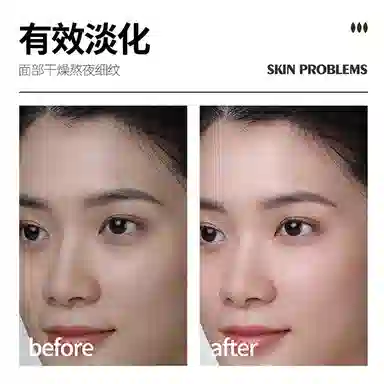 瓷雅 羊胎素冻干粉套盒 补水保湿舒缓修护滋润