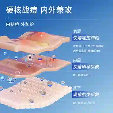 阳菲净颜祛痘精华液 保湿去角质