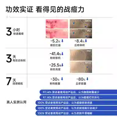 阳菲净颜祛痘精华液 保湿去角质