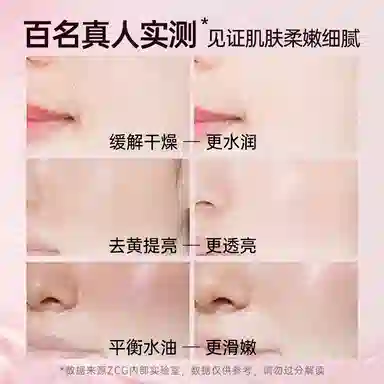 ZCG
