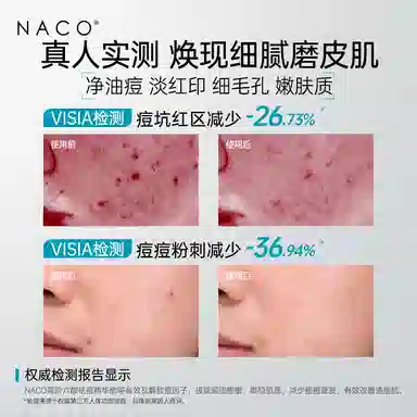 NACO
