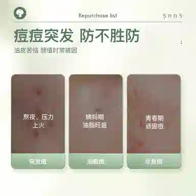 SNNS 18g18g*2