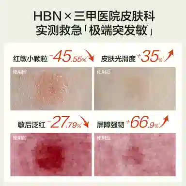 HBN 3.0 50g