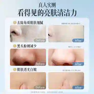200ml
