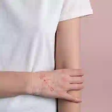 ins6*10cm