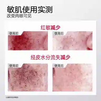 优理氏 酵母修护精华乳 修护维稳 晒后修复