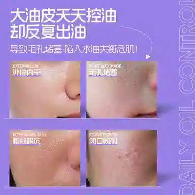 笛爱儿 女士蝴蝶紫苏精华乳 保湿平衡水油收缩毛孔细腻肌肤 补水