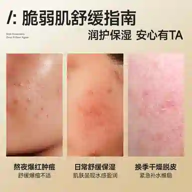 也西 芦荟提亮水润面膜舒缓补水修护敏感肌保湿滋润 护肤套装 植物萃取 收缩毛孔去黑头控油  淡痘印祛痘 洁面乳/去角质