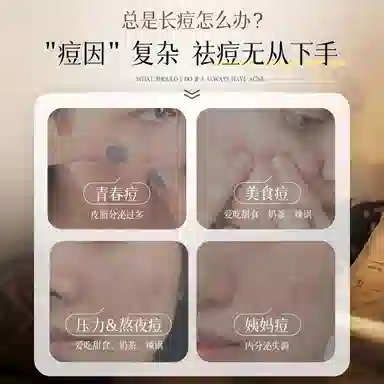 GINBI