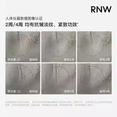 RNW 15ml+15ml