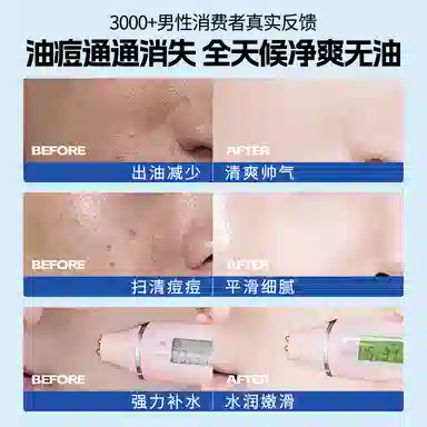 儒意 水杨酸控油净爽男士护肤套装 保湿滋润