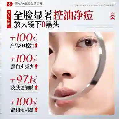 儒意水杨酸祛黑头导出液 去角质去黑头收缩毛孔祛粉刺 控油祛痘粉刺温和无刺激清洁收毛孔