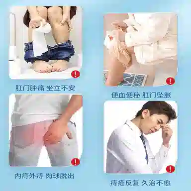 修正 医用级痔疮膏凝胶 内痔外痔混合痔疮肉球肛裂便血 消肿舒缓