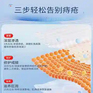 修正 医用级痔疮膏凝胶 内痔外痔混合痔疮肉球肛裂便血 消肿舒缓