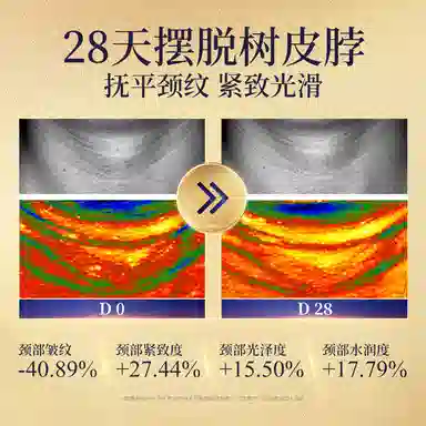 SDX 150g+51