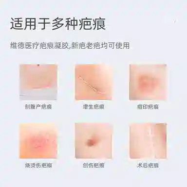 维德医疗 医用疤痕凝胶 除菌 术后增生儿童烧伤痘印疤痕 祛疤凝胶