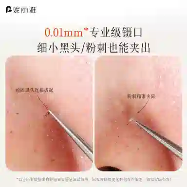 妮丽雅 超细滴胶细胞夹 去黑头刮闭口粉刺痘痘
