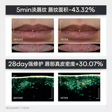 诺卜 唇部精华护唇全家桶 保湿修护提亮淡纹滋润舒缓补水