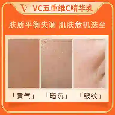 VC VCC 10ml