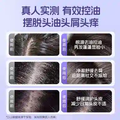 亚玛莉莎 青少年清爽控油蓬松洗发水 光泽去头屑强韧控油改善毛躁柔顺清洁清爽清爽控油滋养滋润舒缓 自然温和