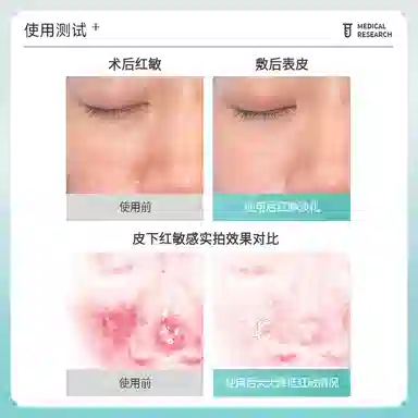 CORTININA III 28ml*5