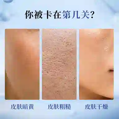 20g*2