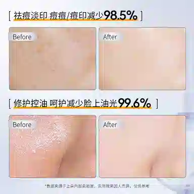 30ml