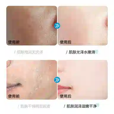 150ml