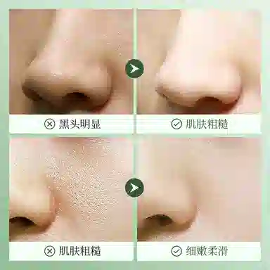 上朵 积雪草泡泡面膜 保湿清洁