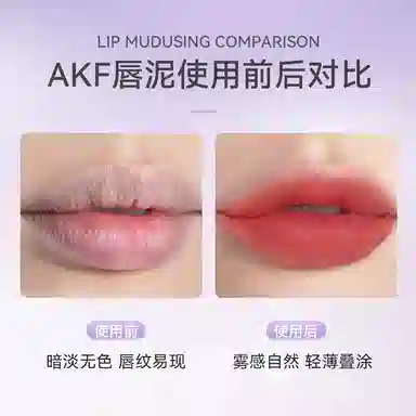 AKF 3g
