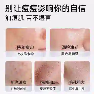 素秀臣氏  皮傲宁胶态硫净颜祛痘霜痘印毛孔粗大油痘粉刺暗沉 清爽型 舒缓 油皮混合肌