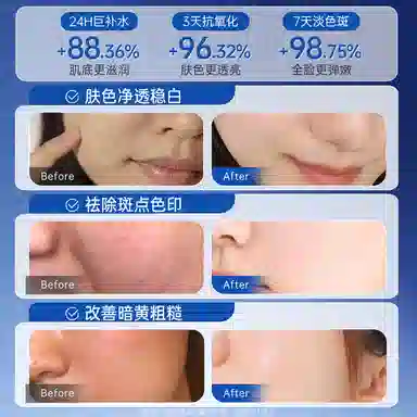 透真 熬夜急救护肤套装 提亮淡斑