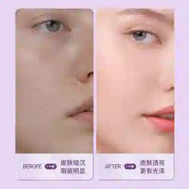 瓷雅 淡斑美白柔肤水 保湿滋润补水收缩毛孔 去黄改善暗沉淡化斑持久水润