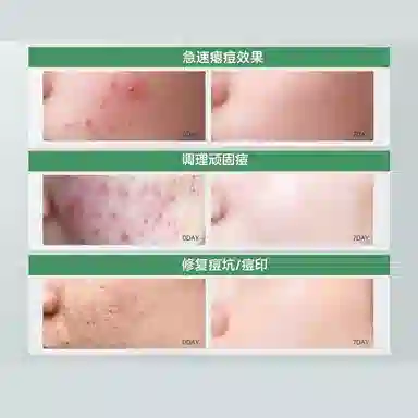 30ml