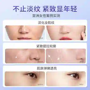 5*28ml