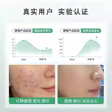 25ml*10